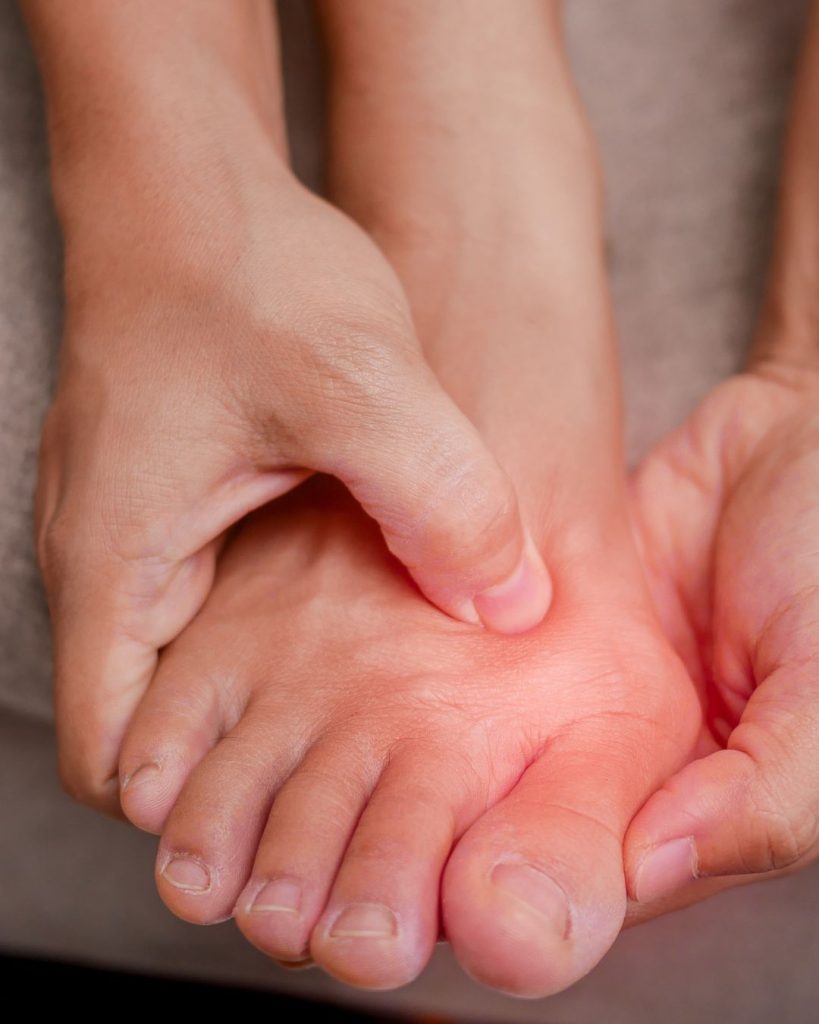 Hallux Valgus : comprendre et prévenir pour mieux vivre !