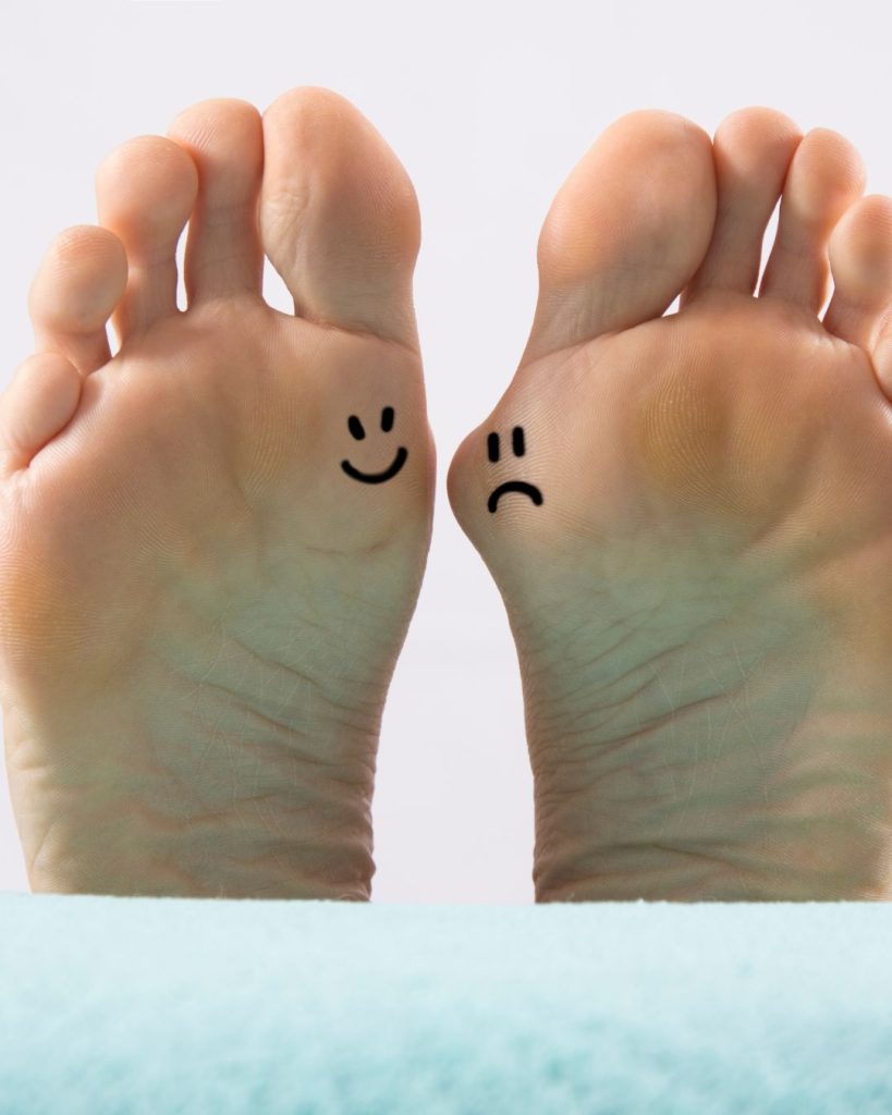 Hallux Valgus : comprendre et prévenir pour mieux vivre !