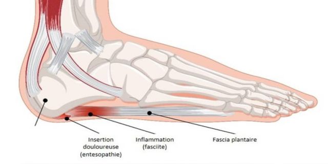 Comment bien choisir ses mules en liège, le guide complet